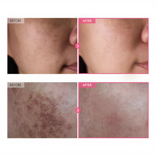 Tosowoong Arbutin Brightening Cream